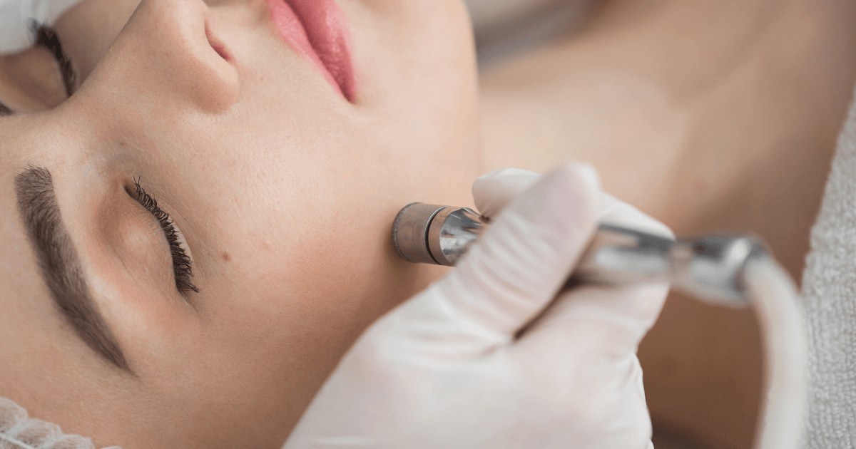 microdermabrasioo